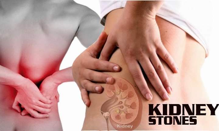 Eat Useful Nutrients and Safe from Leaf Kidney Stone
